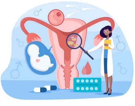 Endometriosis