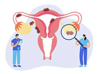 Laparoscopic Ovarian Cystectomy