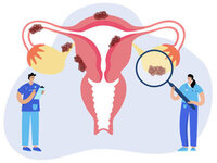 Vaginal Hysterectomy